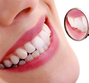 Dental Treatment Cost