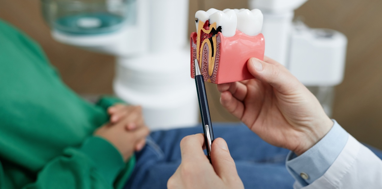 Root Canal Treatments Performed In Our Endodontics Department